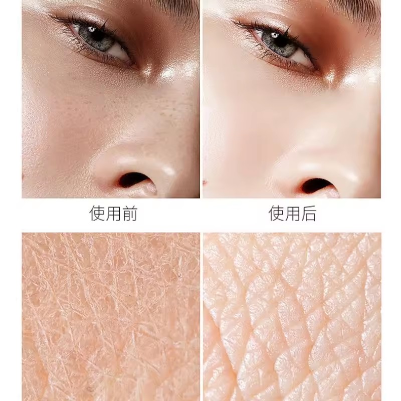 Ácido hialurónico niacinamida  - Niacinamide Pore Shrinking Essence avaliação e preço