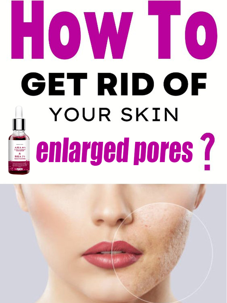 Encolher poros soro salicílico - Salicylic Acid Blackhead Remover avaliação e preço